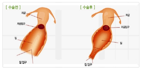 Queen 산부인과