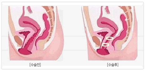 Queen 산부인과